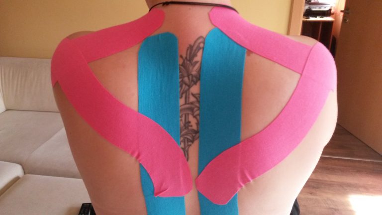 KINESIO TAPE